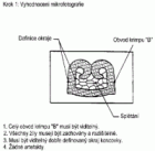 Obr. 3 Vyhodnocení mikrofotografie
